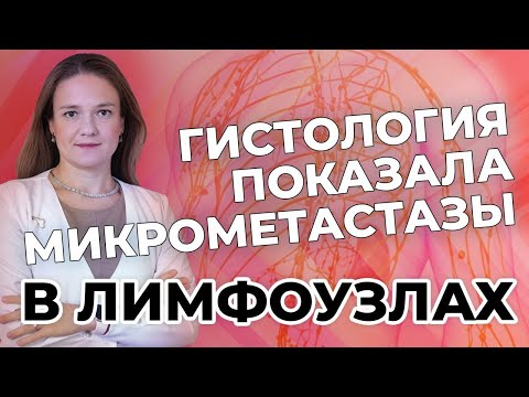 Видео: Гистология показала микрометастазы в лимфоузлах