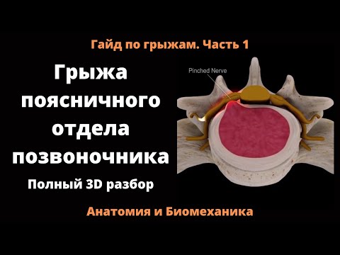 Видео: Грыжа поясничного отдела позвоночника. Полный 3D разбор.