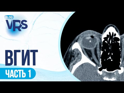 Видео: Травма глаза/ Внутриглазные инородные тела