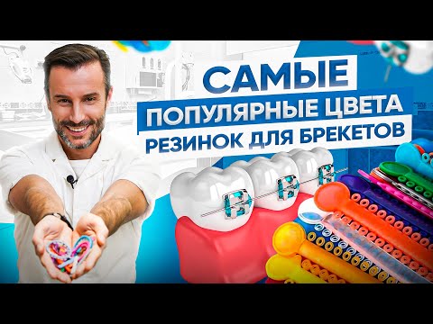 Видео: Самые популярные цвета резинок для брекетов. Как смотрятся на зубах