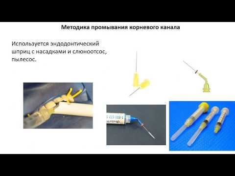 Видео: Эдодонтические технологии в детской стоматологии