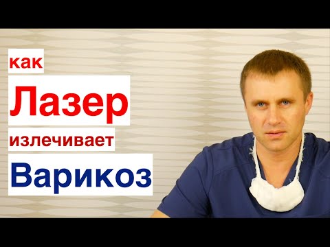 Видео: Лазер излечивает варикоз. МИФ или реальность? ЭВЛК.