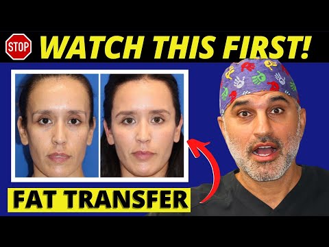 Видео: Основы пересадки жира на лицо: все, что вам нужно знать о пересадке жира на лицо