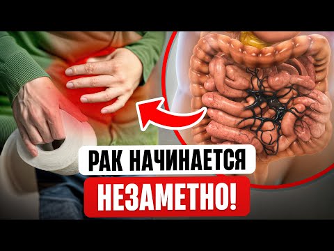 Видео: Первые СИМПТОМЫ РАКА КИШЕЧНИКА. Как предотвратить онкологию?