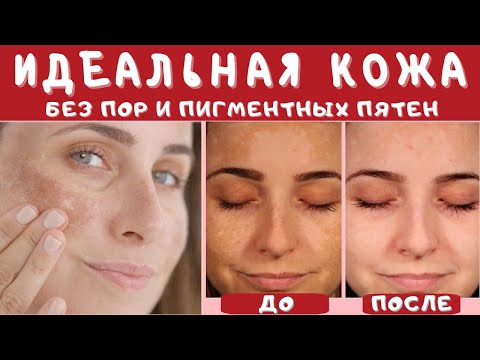 Видео: Здоровая Ровная Идеальная Кожа без Пигментных Пятен, Глубоких Пор💥Исцеление звуком