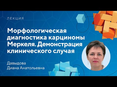 Видео: Морфологическая диагностика карциномы Меркеля. Демонстрация клинического случая // Давыдова Д.А.