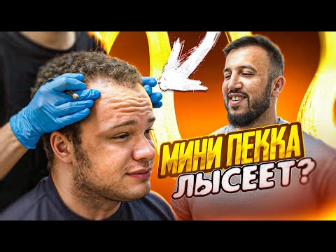 Видео: ЗАЧЕМ МИНИ ПЕККЕ ПЕРЕСАДКА ВОЛОС?