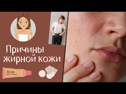 Видео: Причины жирной кожи на лице. Почему жирнеет кожа лица? Как избавиться от жирного блеска на лице?