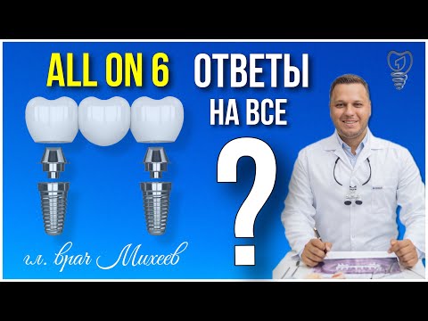 Видео: Всё что вы хотели знать об All on 6. Имплантация зубов.