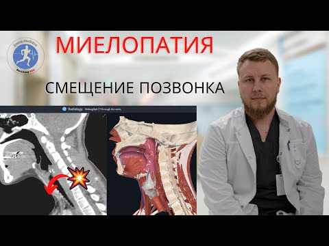 Видео: Миелопатия | разбор МРТ