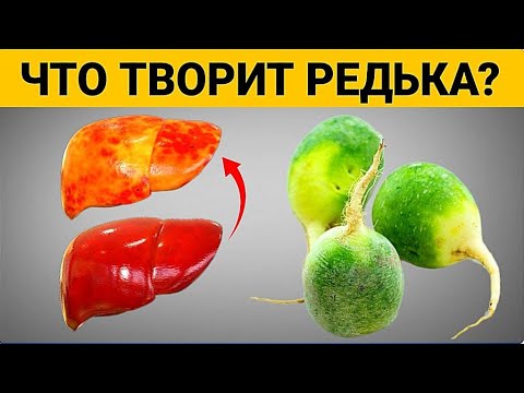 Видео: Даже одна долька ЗЕЛЕНОЙ РЕДЬКИ вызывает НЕОБРАТИМЫЕ ПРОЦЕССЫ в организме. Медики шокированы!