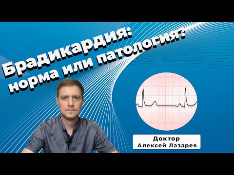 Видео: БРАДИКАРДИЯ: норма или патология? #брадикардия #экг #докторАлексейЛазарев