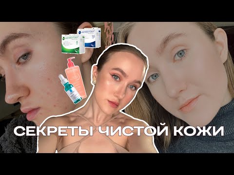 Видео: Рецидив после акнекутана | уход за проблемной кожей | как я избавилась от прыщей