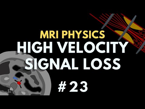 Видео: Потеря сигнала на высокой скорости (HVSL), эффект времени пролёта и турбулентность | Курс физики ...