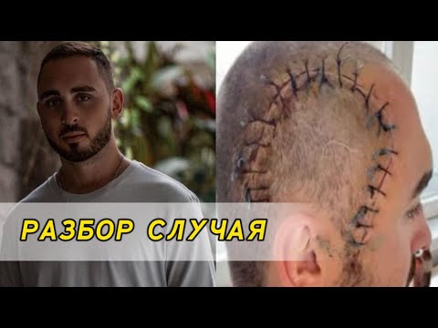 Видео: Разбор случая Олексея Остаповского