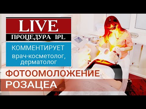 Видео: Процедура фотоомоложения  IPL (пациент Мария)