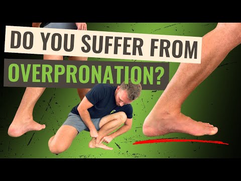 Видео: Страдаете ли вы от чрезмерной пронации стоп? | Начните с этой 10-минутной процедуры