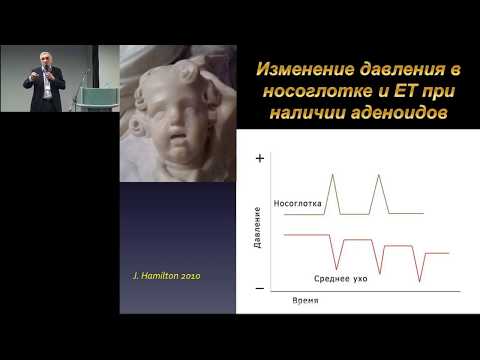 Видео: 17.02.2017 - Отит. Педиатр вместе с ЛОР-врачом: борьба за здоровый респираторный тракт.