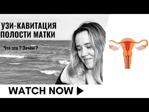Видео: УЗИ-кавитация полости матки: зачем делать, как проходит и сколько стоит? Мой опыт