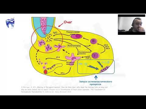 Видео: #3 Вебинар по патогенезу периапикльных очагов.