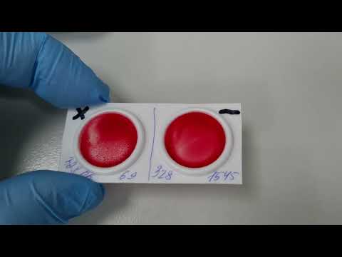 Видео: Проба на индивидуальную совместимость крови донора и реципиента на плоскости.