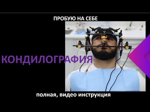 Видео: КОНДИЛОГРАФИЯ ВИДЕО ИНСТРУКЦИЯ (пробую на себе)