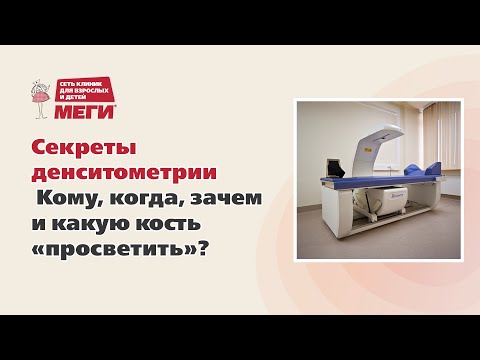 Видео: Секреты денситометрии. Кому, когда, зачем и какую кость «просветить»?