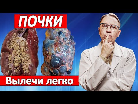 Видео: Больные почки и отказ почек. Как вылечить и предотвратить?