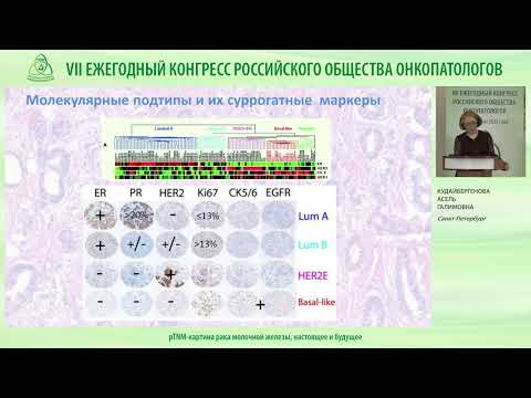 Видео: pTNM-картина рака молочной железы, настоящее и будущее