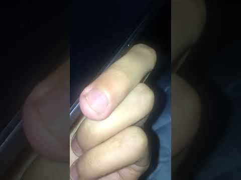 Видео: Митя ворошила 2023