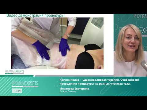 Видео: Мастер класс 13. Криолиполиз + ударноволновая терапия. Особенности проведения процедуры.