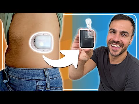 Видео: Я перешёл с Omnipod на Mobi — вот как это было