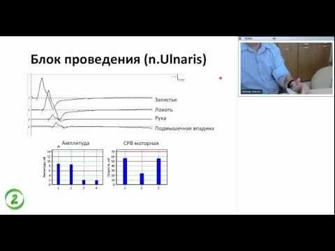 Видео: Вебинар: электромиография и электронейромиография