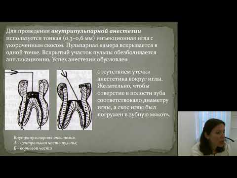 Видео: Местное обезболивание 2.Дополнительные методы местного обезболивания
