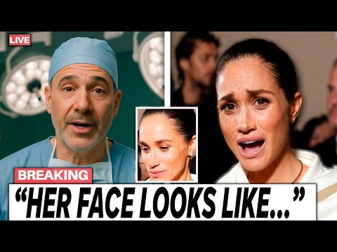 Видео: Меган Маркл в крахе: пластический хирург показал редкие неотфильтрованные фотографии!