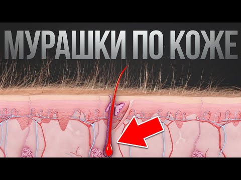 Видео: ПРОБЕЖАЛИСЬ МУРАШКИ ПО КОЖЕ? - ОБЬЯСНЯЕМ ПОЧЕМУ