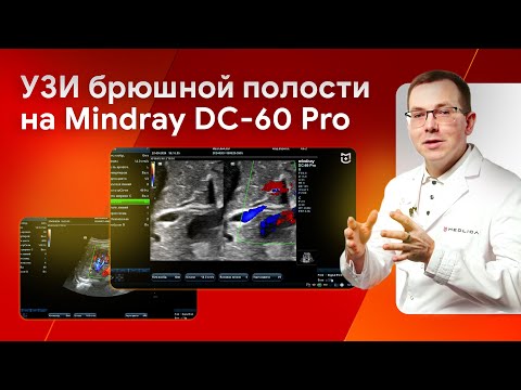 Видео: УЗИ органов брюшной полости (ОБП) на Mindray DC-60 Pro