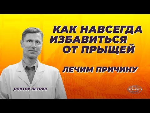 Видео: Как избавиться от прыщей. Лечим причину.