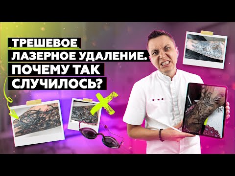 Видео: ТРЕШ кейс удаления татуировки. Как делать НЕЛЬЗЯ!