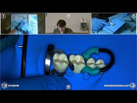 Видео: Обзор на кольцо для матриц #TORVM #Rubberdamology 002 #8kdcv #8K