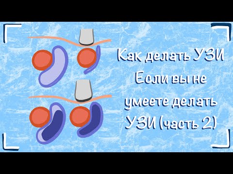 Видео: Как делать УЗИ если вы не умеете делать УЗИ (часть 2)