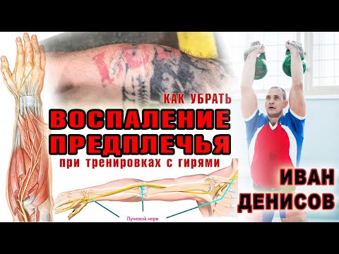 Видео: Как вылечить предплечье при воспалении в гиревом спорте.