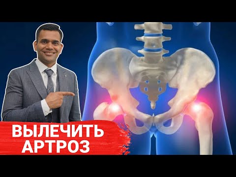Видео: ВЫЛЕЧИТЬ АРТРОЗ или Суставную Боль  - Делайте Это И Будет Лучше. Доктор Вивек