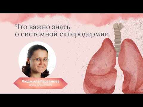 Видео: Системная склеродермия: симптомы, диагностика, лечение