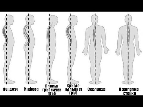 Видео: Как да изправим стойката с една бърза и лесна рутина!