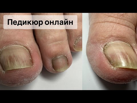 Видео: ПЕДИКЮР ОНЛАЙН. Виктория Авдеева