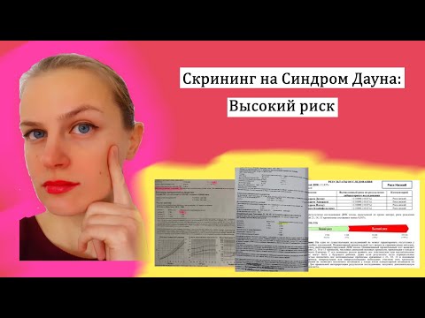 Видео: Скрининг на синдром Дауна: PAPP-A, βhCG, толщина воротникового пространства, кость носа, УЗИ-маркеры