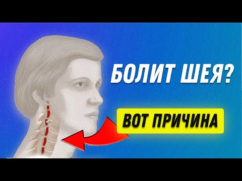 Видео: Болит шея. Почему? Как Лечить? | Остеопат Марина Просветина