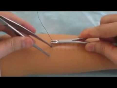 Видео: Техника наложения непрерывного обвивного шва