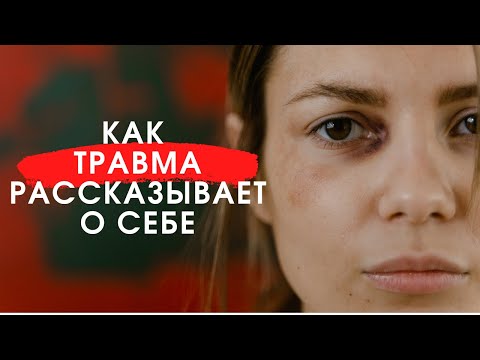 Видео: Как распознать травму